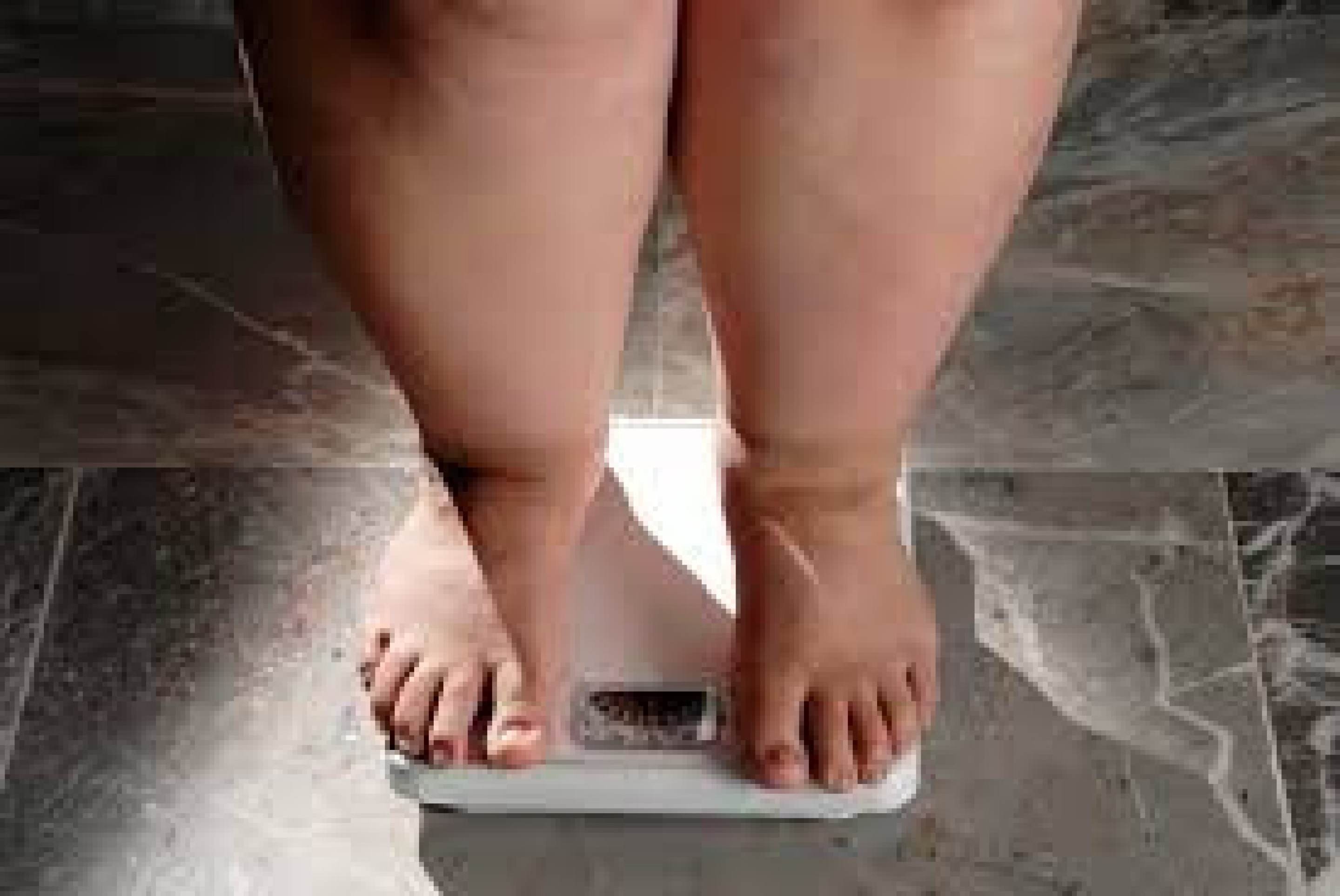 Obesidade na vida adulta é tendência observada na infância, diz estudo