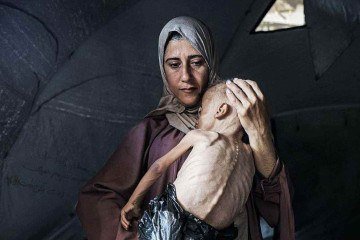 Saiba o que a falta de comida faz com o corpo humano - Getty Images