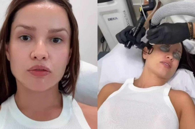 Juliette mostra rosto após procedimentos estéticos com esperma de salmão