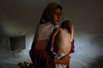 Hidaya, palestina de 31 anos, carrega o bebê desnutrido, Mohammed Al-Mutawaq, de 18 meses, dentro de tenda em Al-Shati (oeste) -  (crédito: Omar Al-Qataa/AFP)