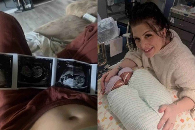 Chelsae Jenner teve de decidir entre a redução fetal ou correr o risco de morrer junto com os bebês - (crédito: Reprodução / TikTok) Chelsae Jenner teve de decidir entre a redução fetal ou correr o risco de morrer junto com os bebês - (crédito: Reprodução / TikTok)