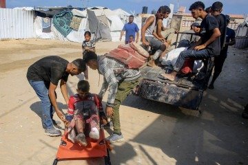 Profissionais de saúde denunciam que crianças não são atingidas por tiros acidentais -  (crédito:  AFP)