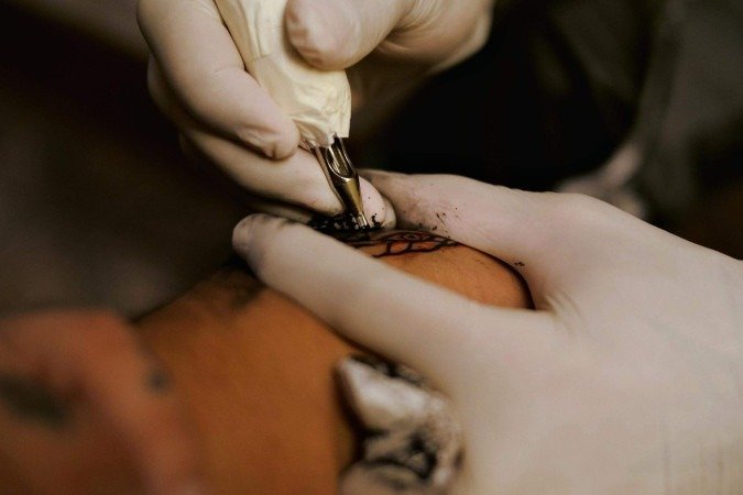 Segundo o documento, o médico não pode aplicar sedação, anestesia geral ou bloqueios anestésicos periféricos, independente do local ou tamanho da tatuagem -  (crédito: Ló Juan/Pexels)