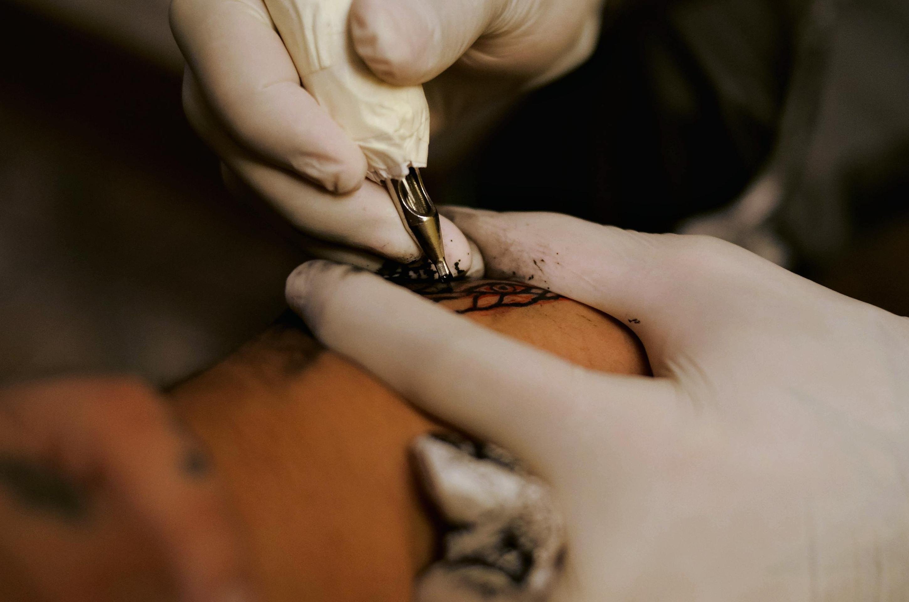 Tatuagem com anestesia está proibida, decide o CFM