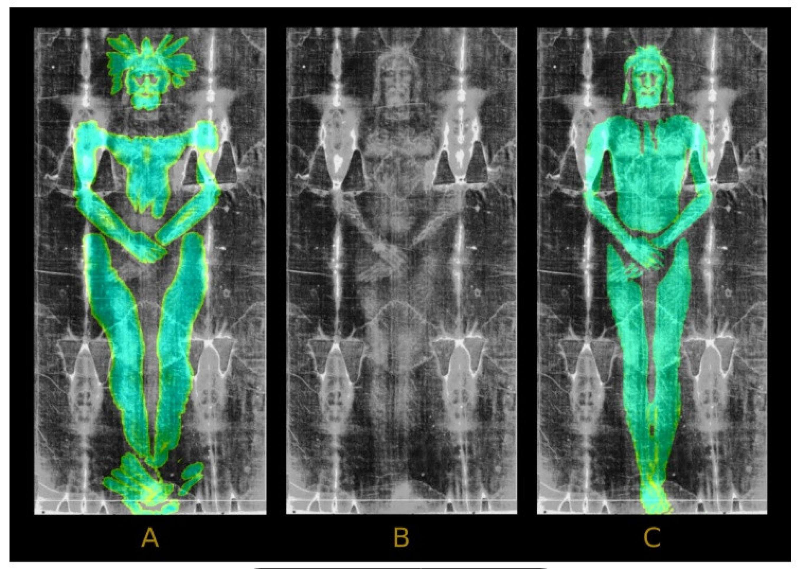 (A) Sobreposição da textura gerada pelo modelo 3D sobre a imagem do Sudário de Turim, mostrando desalinhamento nas proporções anatômicas. (B) Imagem original do Sudário. (C) Sobreposição da textura gerada pelo modelo em baixo relevo, demonstrando maior compatibilidade com a imagem do Sudário, especialmente nas regiões do tronco e da cabeça.