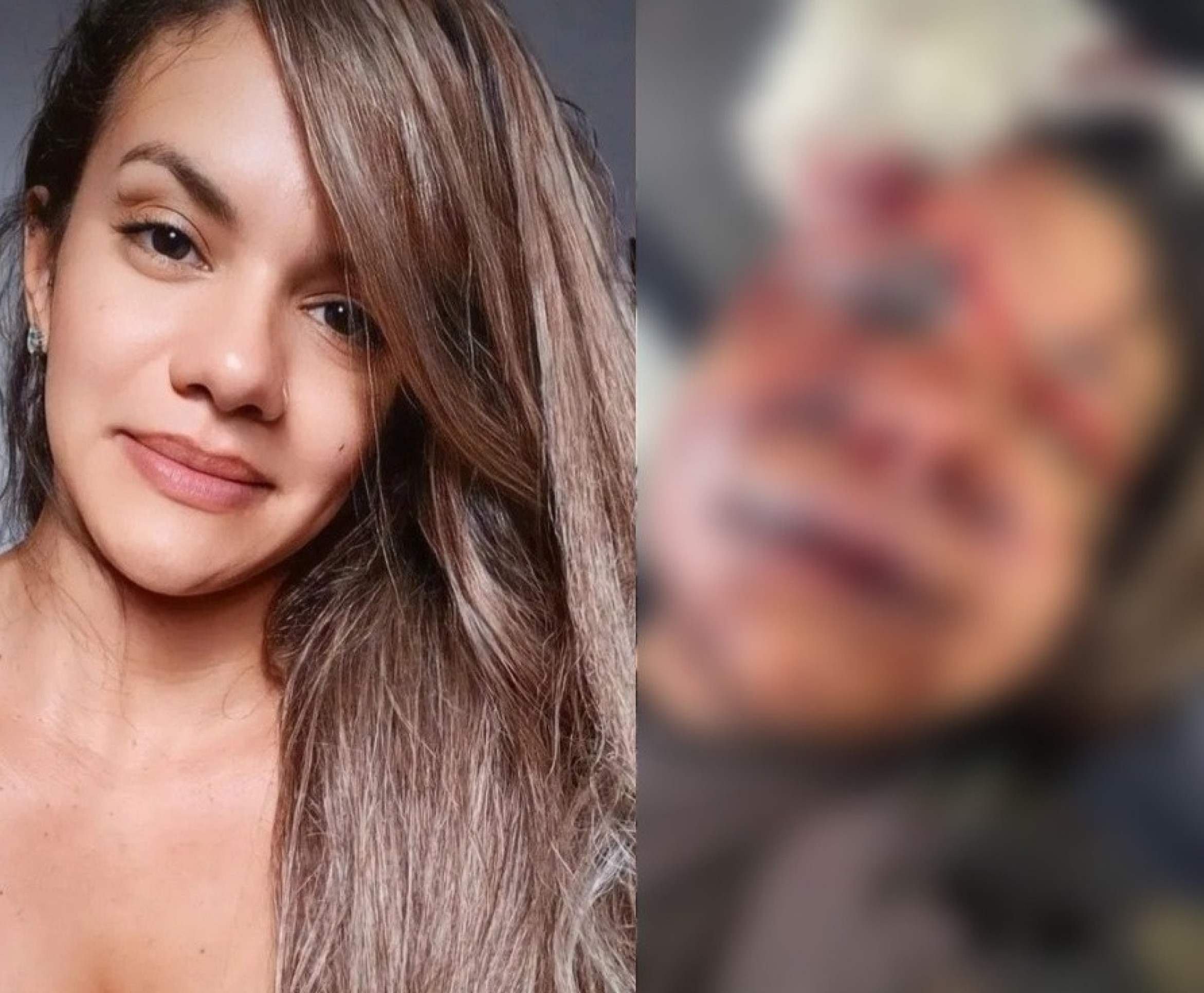 A mulher, temendo ser agredida em um espaço sem câmeras, permaneceu dentro do elevador — o que não impediu o ataque