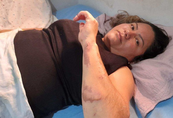  Leticia Mouhamad/CB/D.A Press