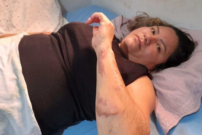  Motorista embriagado e sem habilitação atropelou grupo de fiéis na calçada; nove crianças estão entre os 14 feridos -  (crédito:  Leticia Mouhamad/CB/D.A Press)