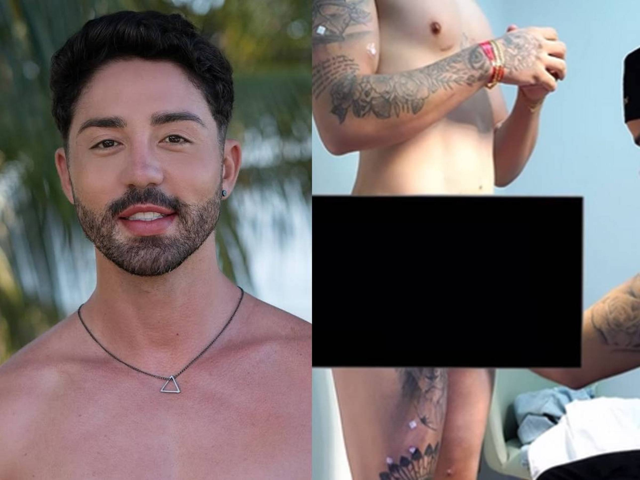 Rico Melquiades realiza harmonização peniana: '3 cm a mais' - (crédito: Observatorio dos Famosos) Rico Melquiades realiza harmonização peniana: '3 cm a mais' - (crédito: Observatorio dos Famosos)