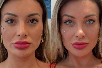 Andressa Urach mudou a cor dos olhos de castanhos para azuis -  (crédito: Reprodução/ Instagram)