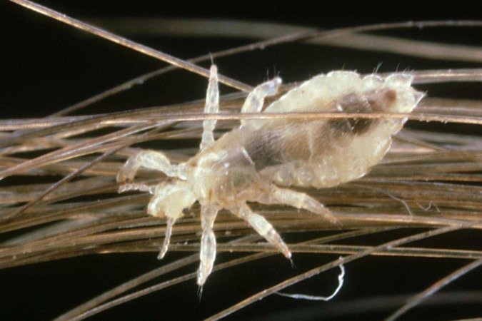 Inseticidas como os piretróides sintéticos podem ser tóxicos para crianças com menos de cinco anos - (crédito: Getty Images) Inseticidas como os piretróides sintéticos podem ser tóxicos para crianças com menos de cinco anos - (crédito: Getty Images)