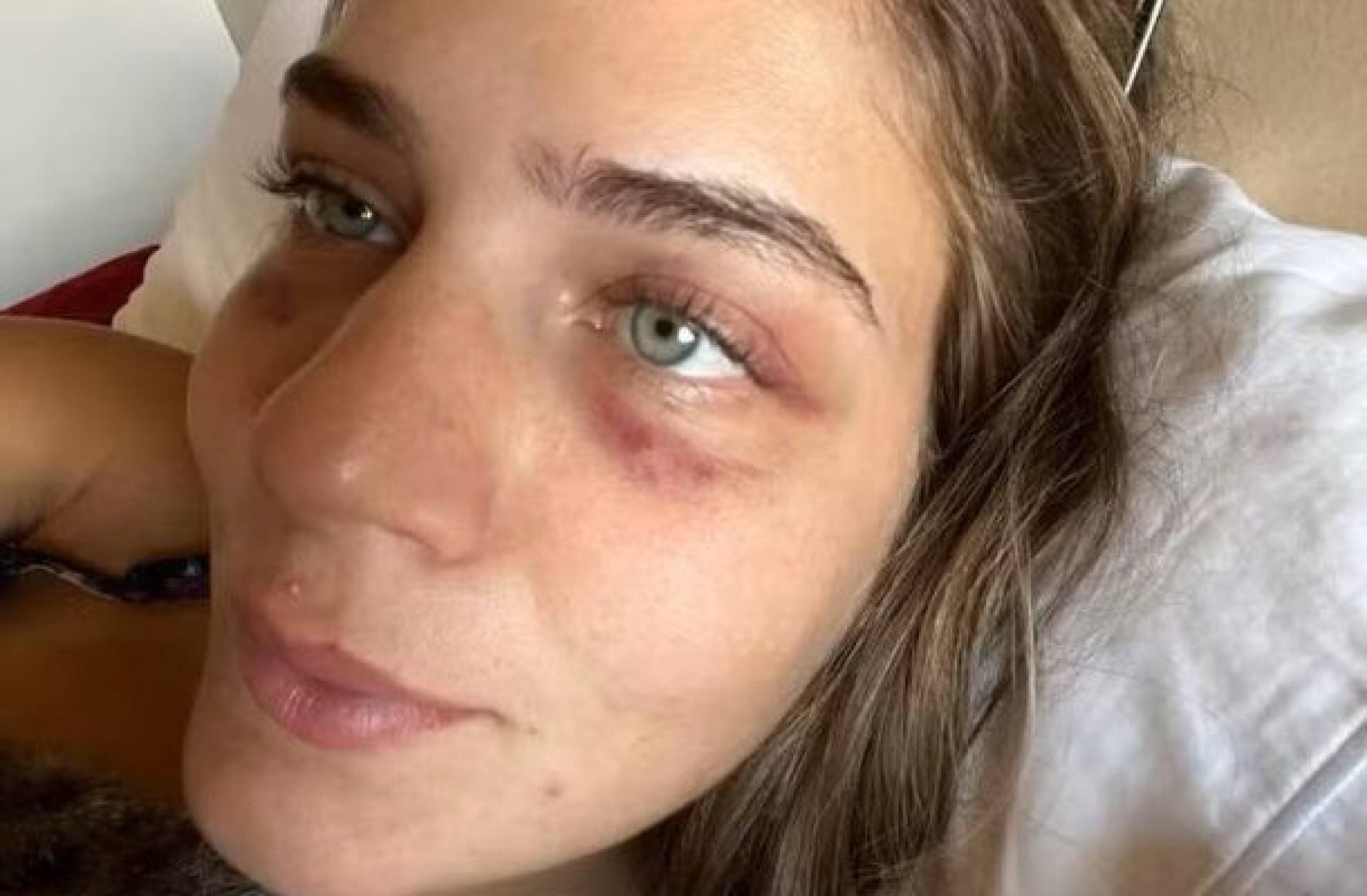 Modelo brasileira acusa ex-jogador do Olimpia de agressões e cárcere privado -  (crédito: Foto: Arquivo Pessoal)