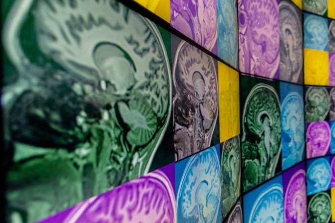 Imagens dos cérebros de 79 idosos: cientistas mensuraram a concentração de três neuroquímicos em áreas-chave do órgão - (crédito: University of the Sunshine Coast/Divulgação) Imagens dos cérebros de 79 idosos: cientistas mensuraram a concentração de três neuroquímicos em áreas-chave do órgão - (crédito: University of the Sunshine Coast/Divulgação)