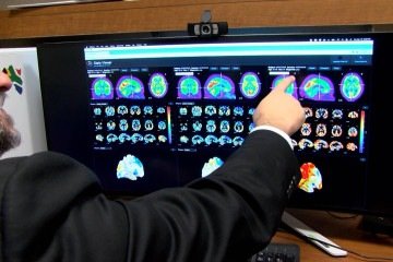 nove tipos de demencia 