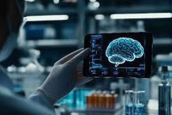 nove tipos de demencia - (crédito: Mayo Clinic ) nove tipos de demencia - (crédito: Mayo Clinic )