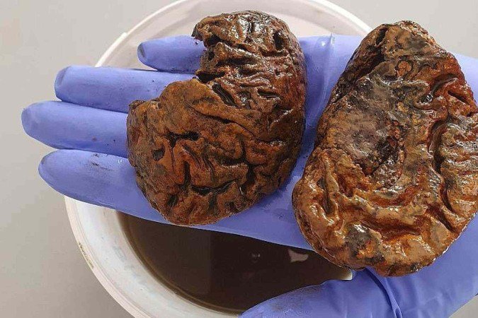 Alexandra Morton-Hayward reuniu uma vasta coleção de cérebros antigos, alguns com até 12 mil anos de idade - (crédito: Alexandra Morton-Hayward) Alexandra Morton-Hayward reuniu uma vasta coleção de cérebros antigos, alguns com até 12 mil anos de idade - (crédito: Alexandra Morton-Hayward)