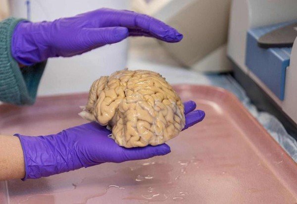 Cérebro de um superager estudado por cientistas da Universidade de Northwestern: padrões celulares distintos da população em geral é uma das causas da preservação cognitiva
