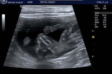 Ultrassonografia realizada pela médica veterinária Marcela Marques - (crédito: Arquivo pessoal. ) Ultrassonografia realizada pela médica veterinária Marcela Marques - (crédito: Arquivo pessoal. )