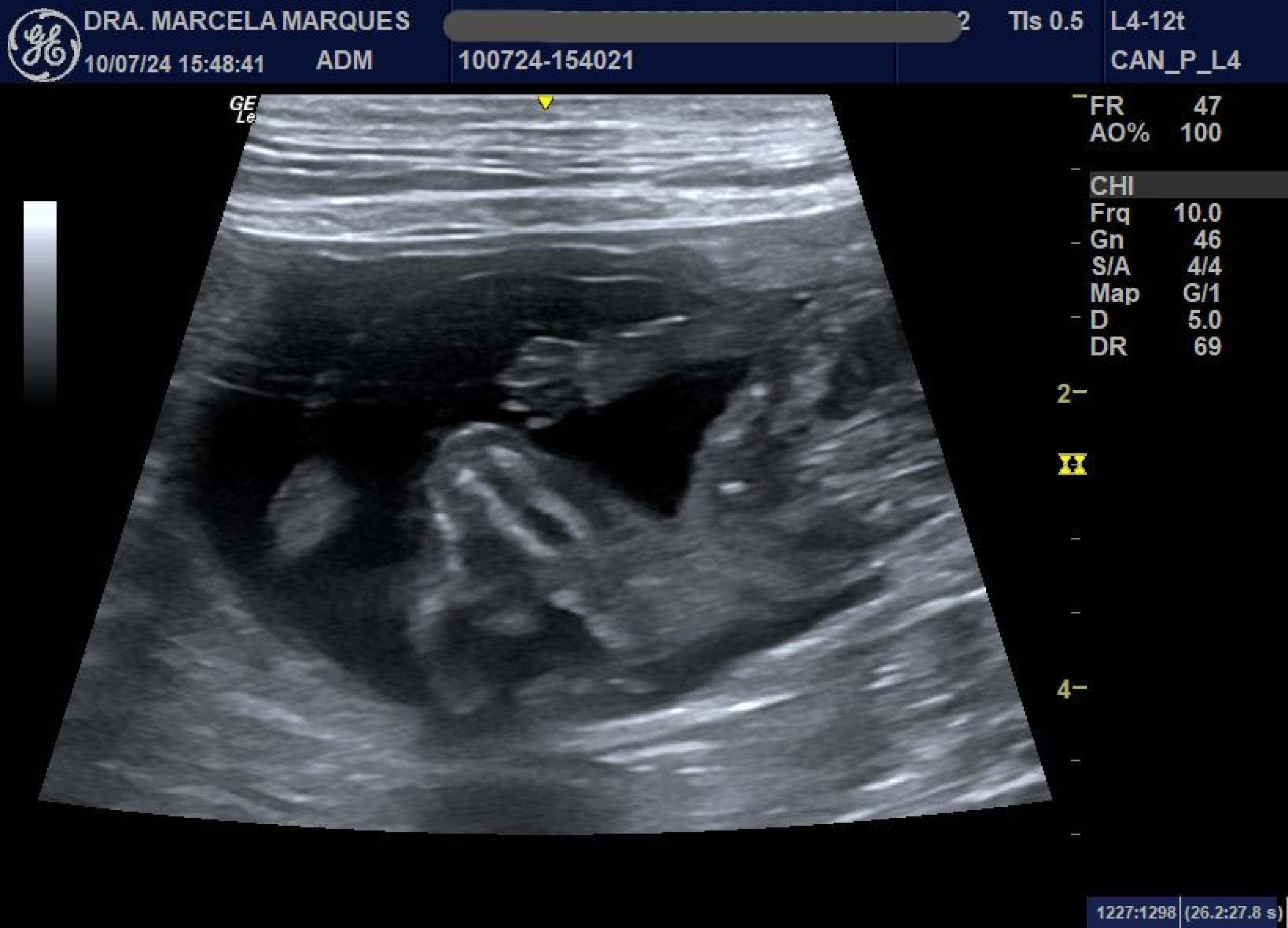  À espera dos filhotes: cuidados essenciais com pets gestantes 