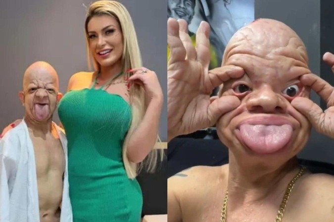 Andressa Urach grava com portador de doença rara e dispara lição de moral -  (crédito: Reprodução/Instagram)