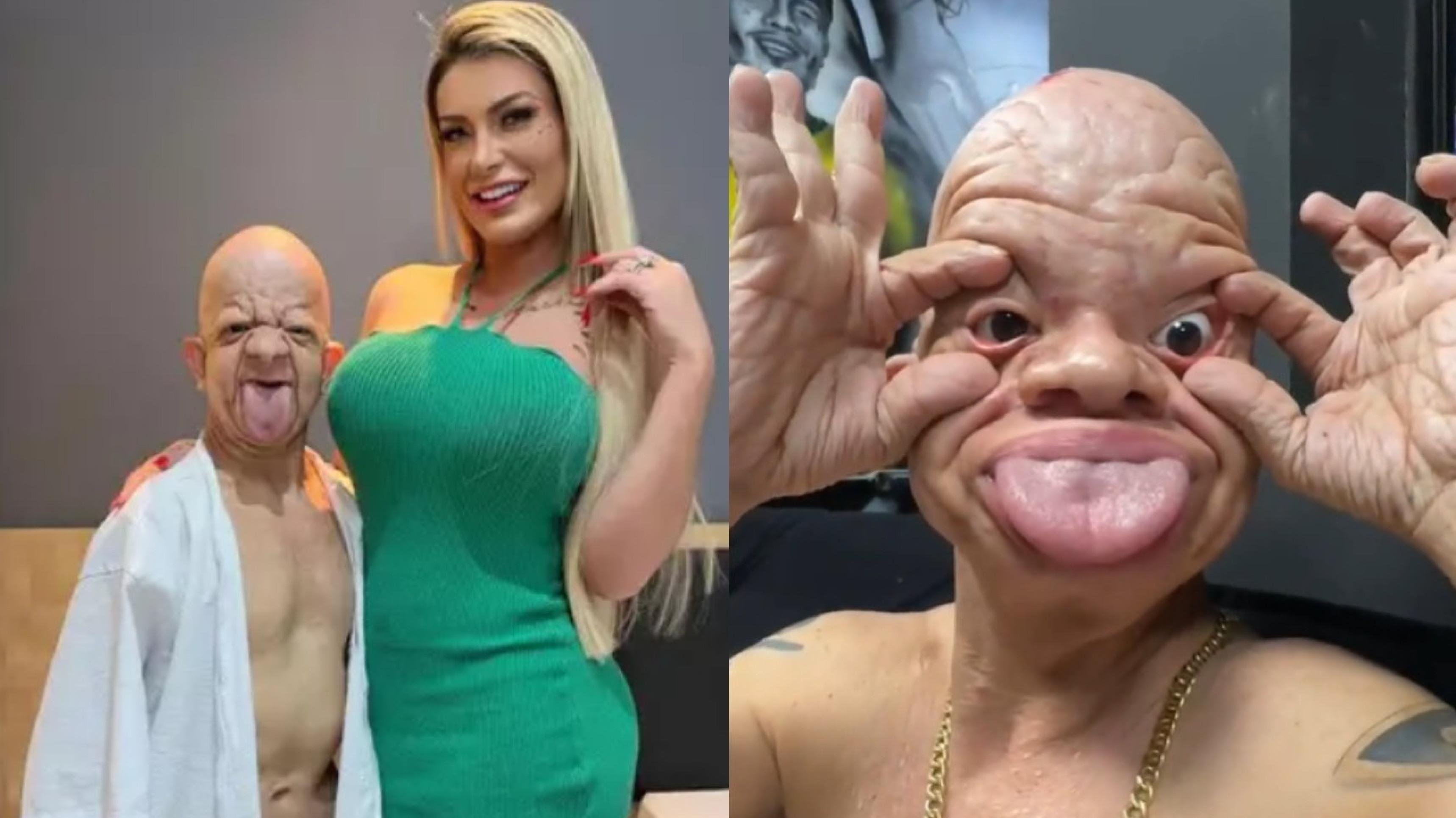 Andressa Urach choca ao anunciar gravação picante com portador de doença rara