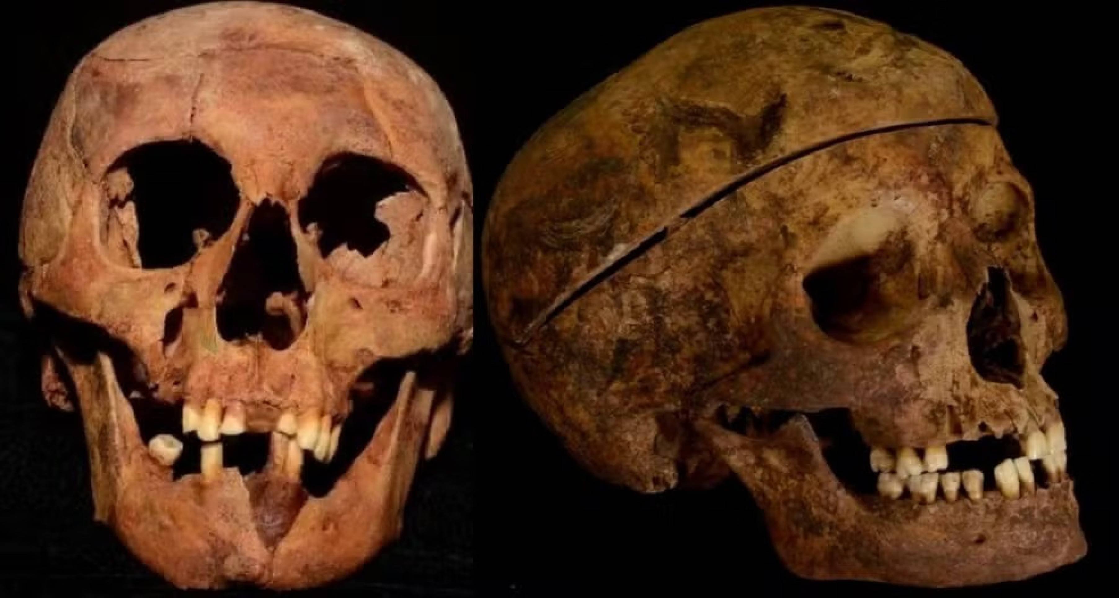 Crânios de Lampião e Maria Bonita foram guardados pela família ao longo de 20 anos Crânios de Lampião e Maria Bonita foram guardados pela família ao longo de 20 anos