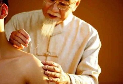 Países com forte tradição em acupuntura incluem China, Japão, Coreia do Sul e Vietnã, onde a técnica faz parte dos sistemas de saúde.  -  (crédito:  Divulgação)