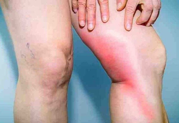  Reprodução/Pinterest