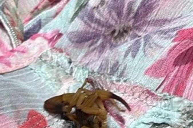 Mulher foi picada por um escorpião dentro do provador de uma loja de roupas - (crédito: Material cedido ao Correio) Mulher foi picada por um escorpião dentro do provador de uma loja de roupas - (crédito: Material cedido ao Correio)