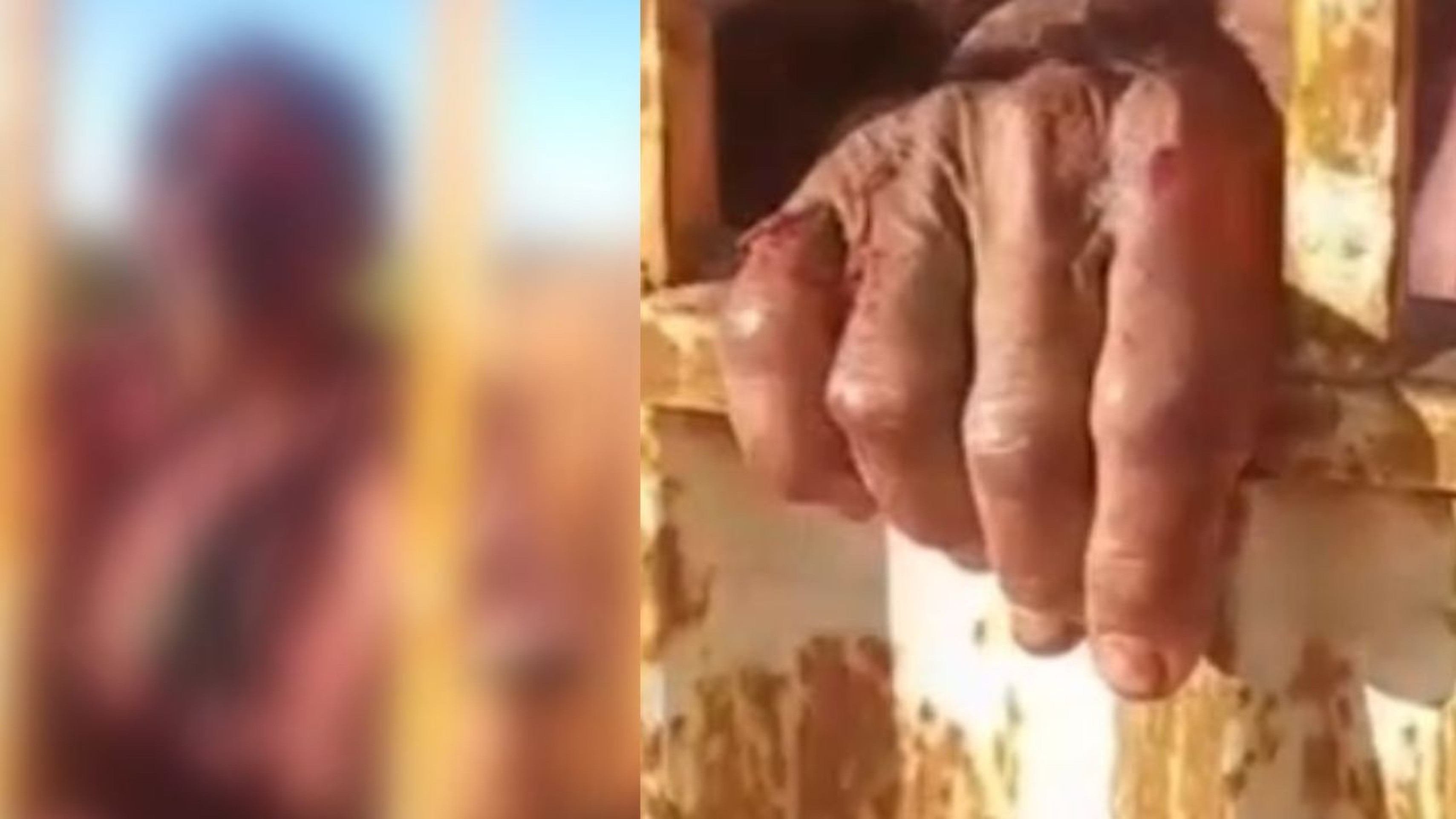 Idoso é esfaqueado em casa após discussão em Águas Lindas (GO); vídeo