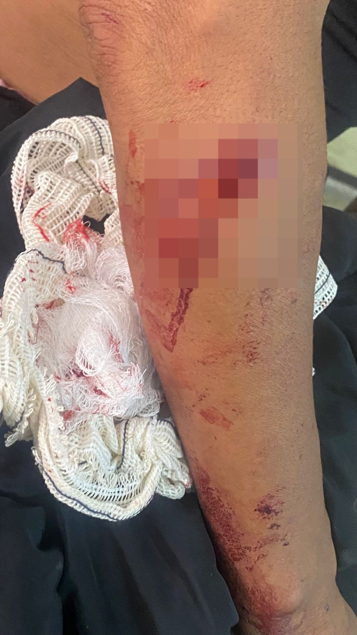 Cães de rua atacam mulher em Ceilândia