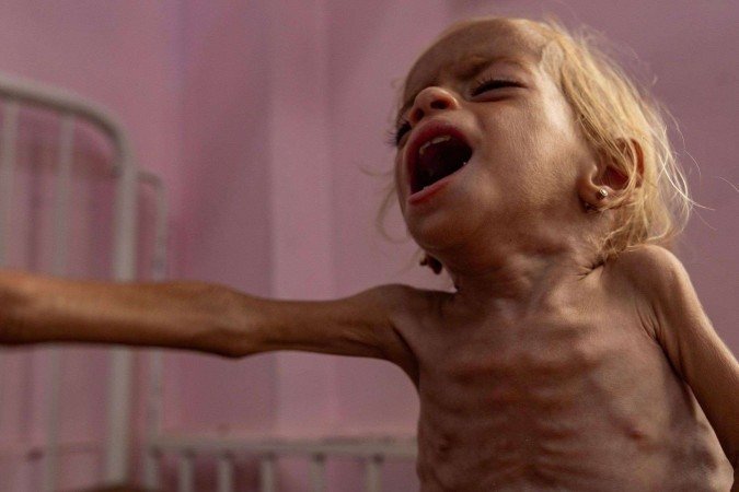 Idoso palestino sofre de desnutrição severa em Khan Younis, cidade palestina situada no sul da Faixa de Gaza -  (crédito: HAITHAM IMAD/EPA/Shutterstock)