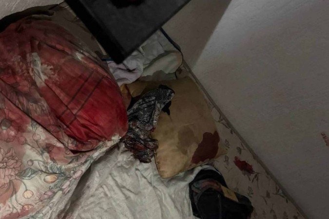 Vítima foi agredida com socos no rosto - (crédito: Material cedido ao Correio) Vítima foi agredida com socos no rosto - (crédito: Material cedido ao Correio)