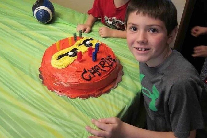 Charlie Drury, que hoje tem 20 anos, precisa de tratamento de troca de plasma regularmente e vai precisar pelo resto da vida -  (crédito: Katy Drury)