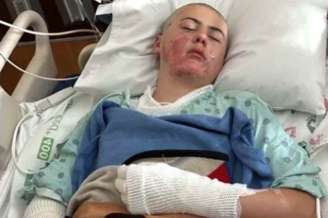 Caden Ballard, de 12 anos, e o irmão mais velho estavam tentando fazer um experimento que havia viralizado nas redes sociais - (crédito: Reprodução/GoFundMe) Caden Ballard, de 12 anos, e o irmão mais velho estavam tentando fazer um experimento que havia viralizado nas redes sociais - (crédito: Reprodução/GoFundMe)