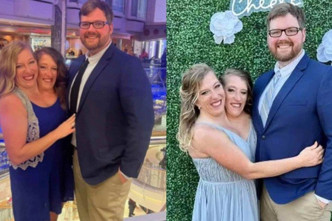 Gêmeas siamesas engravidam juntas, mas só uma é casada; entenda - (crédito: Reprodução/Instagram) Gêmeas siamesas engravidam juntas, mas só uma é casada; entenda - (crédito: Reprodução/Instagram)