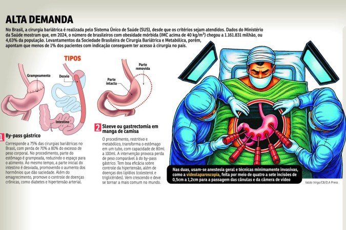 Cirurgia bariátrica lidera entre as alternativas pelo peso ideal