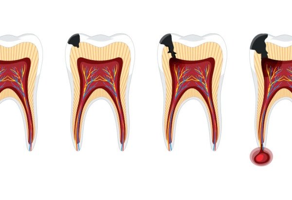 Reprodução/Freepik