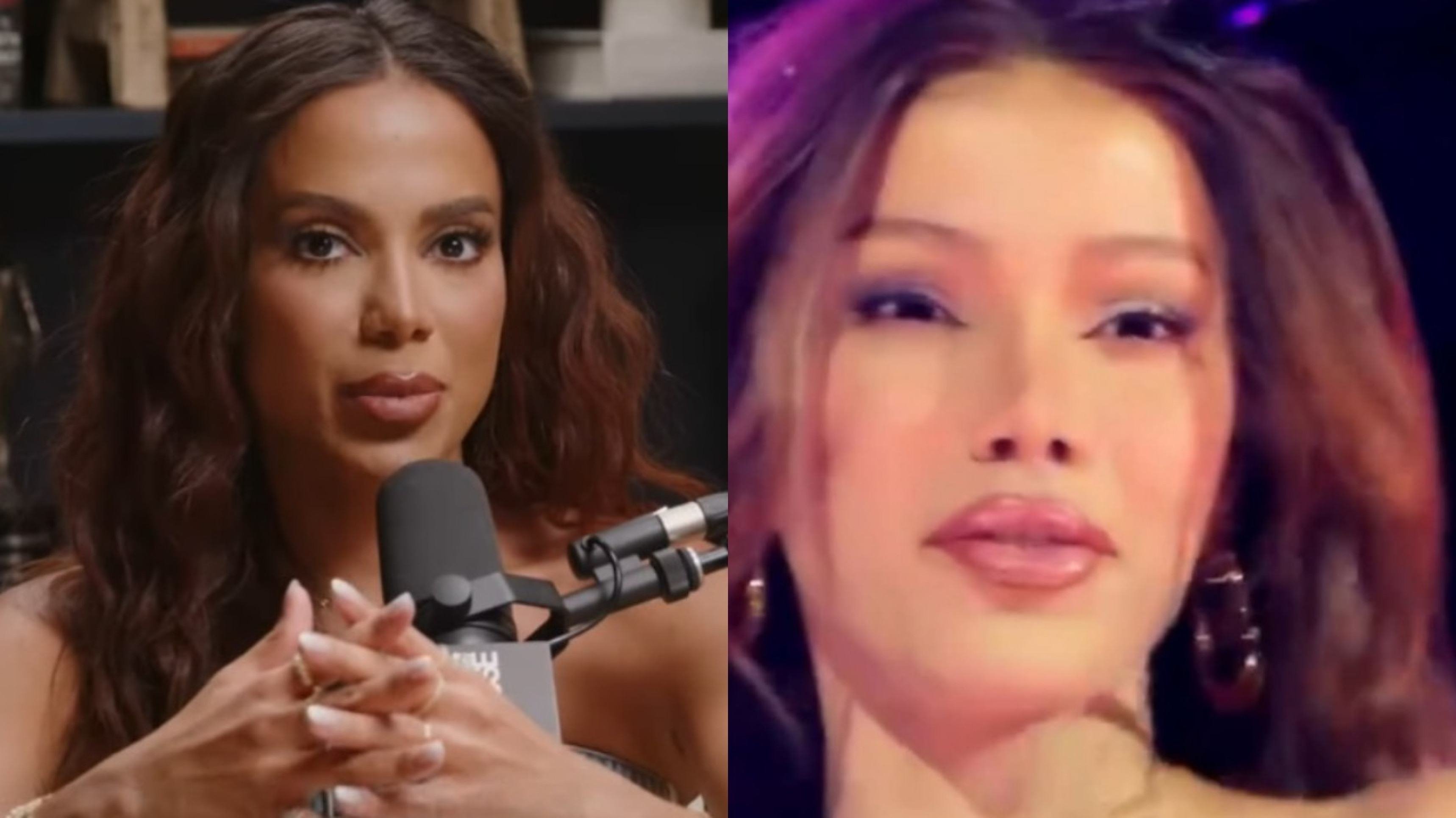 Anitta deixa fãs intrigados com resultado de lifting facial