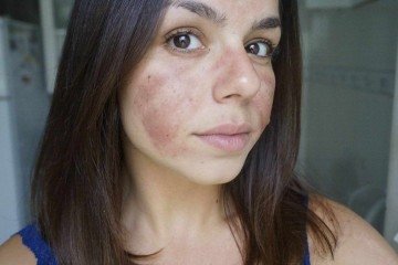 Da experiência negativa nasceu também um novo caminho: Lorena criou sua própria marca 
de cosméticos -  (crédito: Reprodução/Instagram (@lorenarodriguesof))