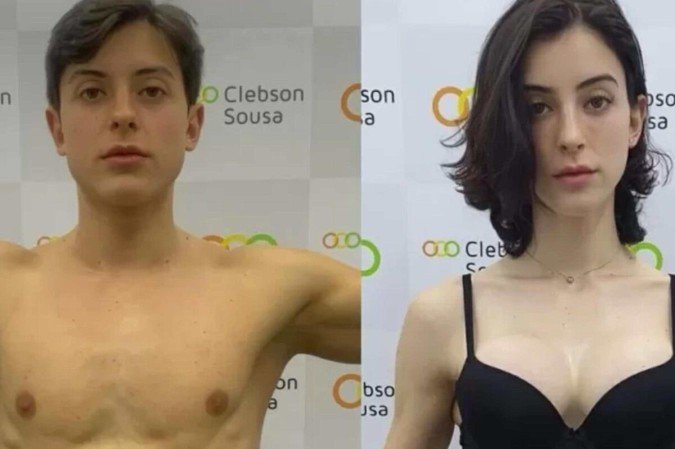 Bella Longuinho mostra antes e depois da transição de gênero