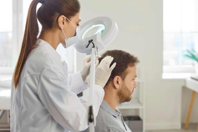 A alopecia areata causa falhas arredondadas no cabelo (Imagem: Studio Romantic | Shutterstock) -  (crédito: EdiCase)