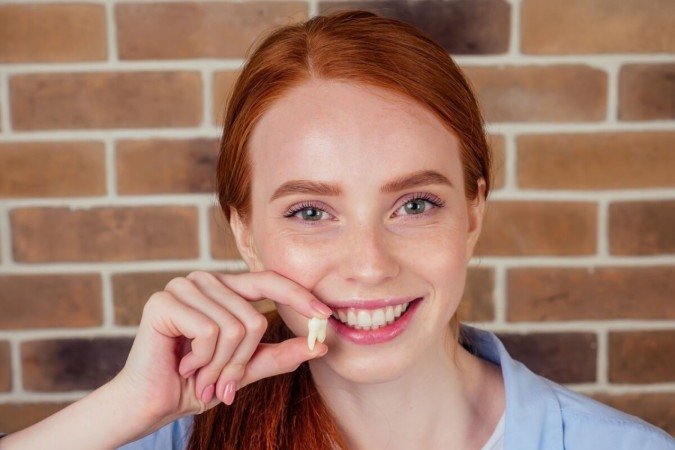 O dente do siso levanta dúvidas sobre necessidade de retirada, cuidados e recuperação (Imagem: yurakrasil | Shutterstock) -  (crédito: EdiCase)