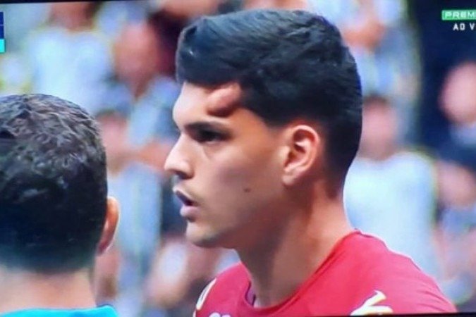 BRAZÃO – Boas defesas, inclusive uma quando já tinha levado a joelhada que o retiraria de campo. E sem culpa no gol. Saiu aos 20 minutos da etapa final por concussão, dando um tremendo susto em todos. NOTA 6,0. Foto: Reprodução de TV