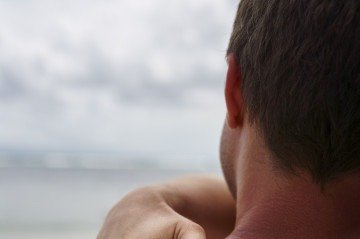 A exposição sem proteção favorece o surgimento de melasma e pode agravar condições dermatológicas pré-existentes, como rosácea e lúpus cutâneo