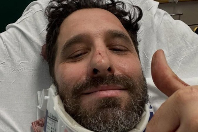 Rafinha Bastos sofre acidente de bicicleta em Nova York e fratura clavícula