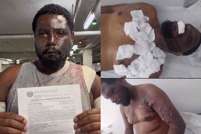 Alexandre registrou um boletim de corrência e passará por exame de corpo de delito -  (crédito: Reprodução/Instagram)