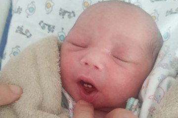 Os dois dentinhos extraídos foram guardados pela família como lembrança do nascimento inusitado de Yan Matteo. -  (crédito: Material cedido ao Correio)
