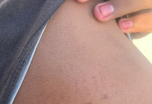 Material cedido ao Correio