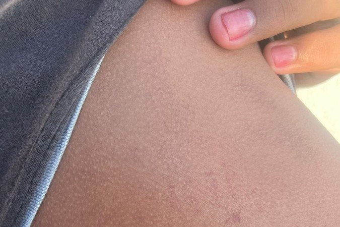 O adolescente sofria agressões constantes, com socos, chutes e mordidas - (crédito: Material cedido ao Correio) O adolescente sofria agressões constantes, com socos, chutes e mordidas - (crédito: Material cedido ao Correio)